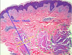 Coupe Histologique Intracel